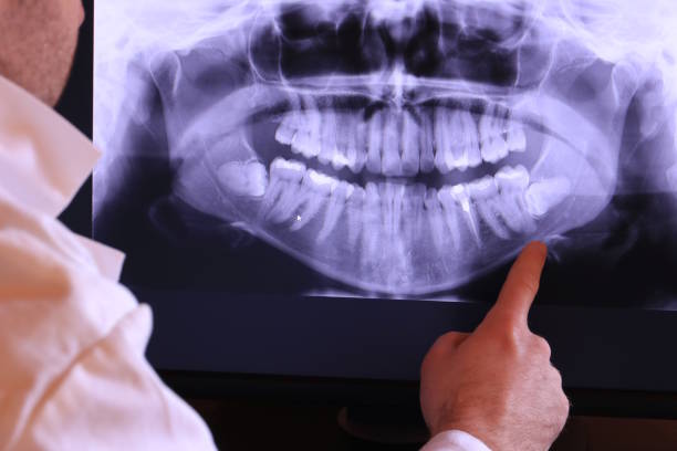 Best Weekend Emergency Dentist in Start, LA